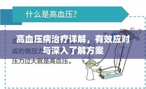 高血压病治疗详解,有效应对与深入了解方案