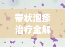 带状泡疹治疗全解析,深入了解与应对策略